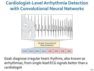 Cardiologist-Level Arrhythmia Detection
with Convolutional Neural Networks
150
Goal: diagnose irregular heart rhythms, also known as
arrhythmias, from single-lead ECG signals better than a
cardiologist
 
