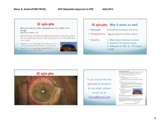 Steve A Arshinoff MD FRCSC OVD Stepladder Approach to IFIS AAO 2014
4
IC xylo-phe
1.  Add minim (0.3 cc) 10% phenylephrine to 5 cc BSS in 6 cc
syringe
(è 0.57%, diluted 17.7x).
2.  Add 3-4 drops of above phenylephrine solution to xylocaine (Astra
1% non-preserved insotonic xylo polyamp) on scrub tray (è0.05%,
diluted ≥200x).
3.  Inject 0.1 cc IC xylo-phe thru side port. (1.)
— Almost all pupils dilate to 8-9 mm in 10 seconds.
4.  Inject 0.1 cc IC xylo-phe under OVD. (2.)
— 1 more mm of pupil dilation.
IC xylo-phe: Why it works so well.
—  Xylocaine: Completely paralyzes sphincter.
—  Phenylephrine: Aggressively stimulates dilator.
* Benefits: 1. Maximally enhances iris tone.
2. Great for all cataract cases.
3. Adequate for 90+ % IFIS cases.
4. Safe
IC xylo-phe
If you would like this
xylo-phe formulation
& use sheet, please
email me at:
ifix2is@Gmail.com
 