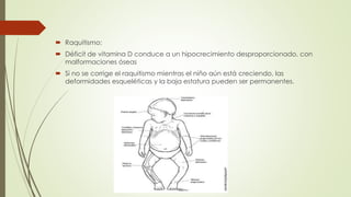  Raquitismo:
 Déficit de vitamina D conduce a un hipocrecimiento desproporcionado, con
malformaciones óseas
 Si no se corrige el raquitismo mientras el niño aún está creciendo, las
deformidades esqueléticas y la baja estatura pueden ser permanentes.
 