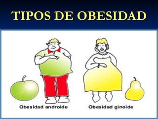 TIPOS DE OBESIDAD
TIPOS DE OBESIDAD
 