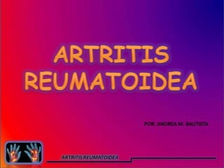 ARTRITIS  REUMATOIDEA POR: ANDREA M. BAUTISTA 