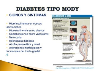 DIABETES TIPO MODY TALLER 4 | PPT | Diabetes | Diseases and Conditions