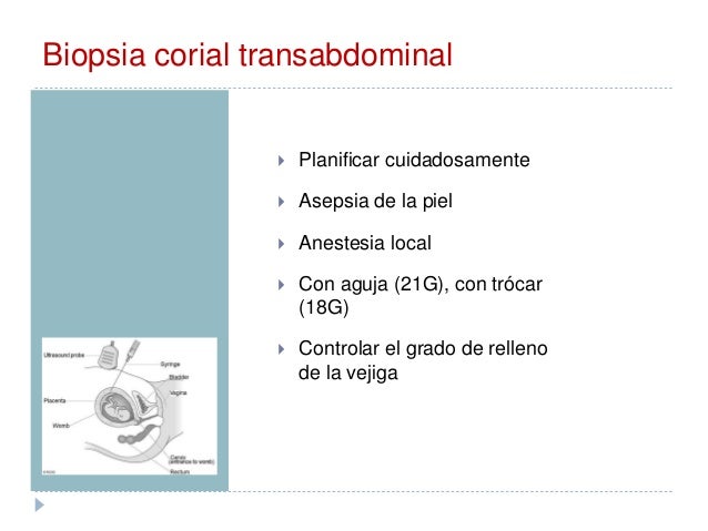 Cuantos Días Se Sangra Después De Una Biopsia Corial es.slideshare.net