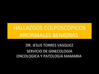 HALLAZGOS COLPOSCOPICOS
ANORMALES BENIGNAS
DR. JESUS TORRES VASQUEZ
SERVICIO DE GINECOLOGIA
ONCOLOGICA Y PATOLOGIA MAMARIA
 
