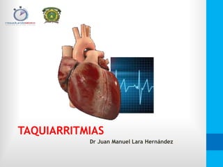 TAQUIARRITMIAS
Dr Juan Manuel Lara Hernández
 