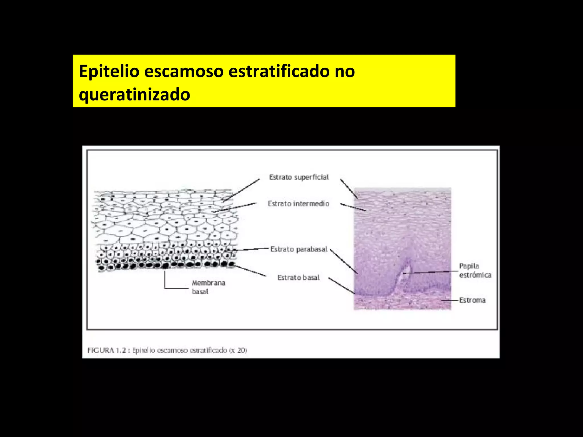 Taller b zona de transformacion metaplasia | PPT