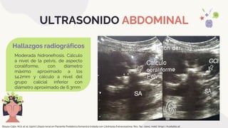 TALLER DE ABDOMEN NORMAL Y PATOLÓGICO EQUIPO 6 IMAGENOLOGIA.pptx