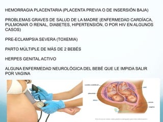 HEMORRAGIA PLACENTARIA (PLACENTA PREVIA O DE INSERSIÓN BAJA)
PROBLEMAS GRAVES DE SALUD DE LA MADRE (ENFERMEDAD CARDÍACA,
PULMONAR O RENAL, DIABETES, HIPERTENSIÓN, O POR HIV EN ALGUNOS
CASOS)
PRE-ECLAMPSIA SEVERA (TOXEMIA)
PARTO MÚLTIPLE DE MÁS DE 2 BEBÉS
HERPES GENITAL ACTIVO
ALGUNA ENFERMEDAD NEUROLÓGICA DEL BEBÉ QUE LE IMPIDA SALIR
POR VAGINA
 