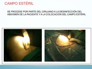 SE PROCEDE POR PARTE DEL CIRUJANO A LA DESINFECCIÓN DEL
ABDOMEN DE LA PACIENTE Y A LA COLOCACIÓN DEL CAMPO ESTÉRIL
CAMPO ESTÉRIL
 