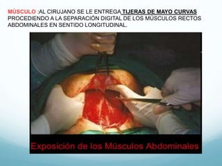 MÚSCULO :AL CIRUJANO SE LE ENTREGA TIJERAS DE MAYO CURVAS
PROCEDIENDO A LA SEPARACIÓN DIGITAL DE LOS MÚSCULOS RECTOS
ABDOMINALES EN SENTIDO LONGITUDINAL.
 