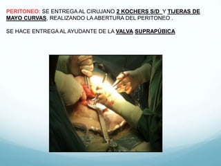 PERITONEO: SE ENTREGA AL CIRUJANO 2 KOCHERS S/D Y TIJERAS DE
MAYO CURVAS, REALIZANDO LA ABERTURA DEL PERITONEO .
SE HACE ENTREGA AL AYUDANTE DE LA VALVA SUPRAPÚBICA
 