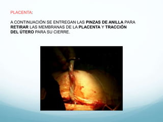 PLACENTA:
A CONTINUACIÓN SE ENTREGAN LAS PINZAS DE ANILLA PARA
RETIRAR LAS MEMBRANAS DE LA PLACENTA Y TRACCIÓN
DEL ÚTERO PARA SU CIERRE.
 
