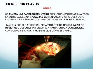 SE SUJETA LAS PAREDES DEL ÚTERO CON LAS PINZAS DE ANILLA TRAS
LA ENTREGA DEL PORTAAGUJAS MONTADO CON VICRYL DEL 1 DE A.
CILÍNDRICA Y SE SUTURA CON PUNTOS GRANDES Y TIJERA DE HILO.
TAMBIEN PUEDEN NECESITAR SEPARADORES DE ROUX O VALVA DE
DOYEN QUE DEBEN ESTAR SIEMPRE A MANO JUNTO A LA CAZOLETA
CON SUERO TIBIO POR SI HUBIESE QUE LAVAR EL CAMPO.
CIERRE POR PLANOS
ÚTERO
 