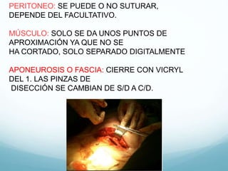 PERITONEO: SE PUEDE O NO SUTURAR,
DEPENDE DEL FACULTATIVO.
MÚSCULO: SOLO SE DA UNOS PUNTOS DE
APROXIMACIÓN YA QUE NO SE
HA CORTADO, SOLO SEPARADO DIGITALMENTE
APONEUROSIS O FASCIA: CIERRE CON VICRYL
DEL 1. LAS PINZAS DE
DISECCIÓN SE CAMBIAN DE S/D A C/D.
 
