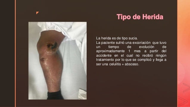 z
La herida es de tipo sucia.
La paciente sufriÃ³ una excoriaciÃ³n que tuvo
un tiempo de evoluciÃ³n de
aproximadamente 1 mes ...
