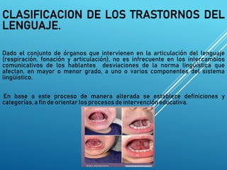 CLASIFICACION DE LOS TRASTORNOS DEL
LENGUAJE.
Dado el conjunto de órganos que intervienen en la articulación del lenguaje
(respiración, fonación y articulación), no es infrecuente en los intercambios
comunicativos de los hablantes desviaciones de la norma lingüística que
afectan, en mayor o menor grado, a uno o varios componentes del sistema
lingüístico.
En base a este proceso de manera alterada se establece definiciones y
categorías, a fin de orientar los procesos de intervencióneducativa.
 