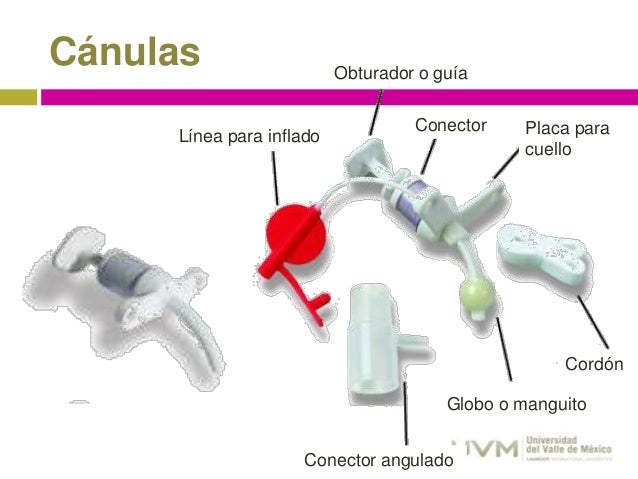 anatomia-do-procedimento-de-traqueostomia-cuidados-de-traqueostomia
