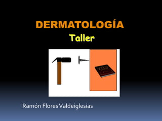 DERMATOLOGÍA 
Taller 
Ramón Flores Valdeiglesias 
 