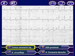 Tronco	
  coronario	
  izq.	
  
A.	
  circunﬂeja	
  
ADA	
  proximal	
  
A.	
  Coronaria	
  derecha	
  
 