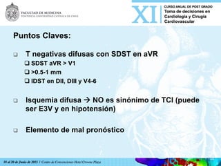 Puntos Claves:
q  T negativas difusas con SDST en aVR
q SDST aVR > V1
q >0.5-1 mm
q IDST en DII, DIII y V4-6
q  Isquemia difusa à NO es sinónimo de TCI (puede
ser E3V y en hipotensión)
q  Elemento de mal pronóstico
 