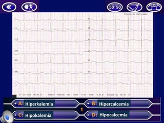 Hiperkalemia	
  
Hipokalemia	
  
Hipercalcemia	
  
Hipocalcemia	
  
 
