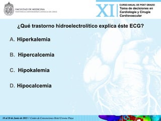 ¿Qué trastorno hidroelectrolítico explica éste ECG?
A.  Hiperkalemia
B.  Hipercalcemia
C.  Hipokalemia
D.  Hipocalcemia	
  
 