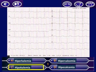 Hiperkalemia	
  
Hipokalemia	
  
Hipercalcemia	
  
Hipocalcemia	
  
 