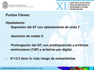 Puntos Claves:
Hipokalemia:
-  Depresión del ST con aplanamiento de onda T
-  Aparición de ondas U.
-  Prolongación del QT, con predisposición a arritmias
ventriculares (TdP) y arritmias por digital.
- K+<3.2 tiene 3v más riesgo de extrasistolías
 