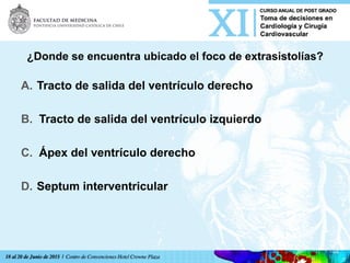 ¿Donde se encuentra ubicado el foco de extrasistolías?
A.  Tracto de salida del ventrículo derecho
B.  Tracto de salida del ventrículo izquierdo
C.  Ápex del ventrículo derecho
D.  Septum interventricular	
  
 