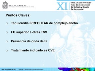Puntos Claves:
q  Taquicardia IRREGULAR de complejo ancho
q  FC superior a otras TSV
q  Presencia de onda delta
q  Tratamiento indicado es CVE
 