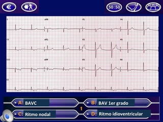 BAVC	
  
Ritmo	
  nodal	
  
BAV	
  1er	
  grado	
  
Ritmo	
  idioventricular	
  
 