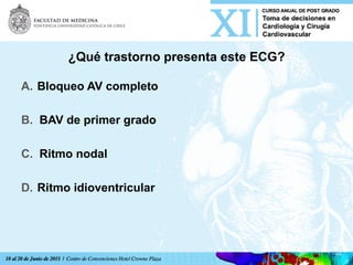 ¿Qué trastorno presenta este ECG?
A.  Bloqueo AV completo
B.  BAV de primer grado
C.  Ritmo nodal
D.  Ritmo idioventricular	
  
 