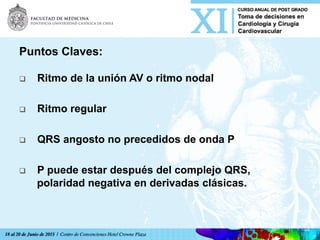 Puntos Claves:
q  Ritmo de la unión AV o ritmo nodal
q  Ritmo regular
q  QRS angosto no precedidos de onda P
q  P puede estar después del complejo QRS,
polaridad negativa en derivadas clásicas.
 