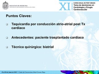 Puntos Claves:
q  Taquicardia por conducción atrio-atrial post Tx
cardiaco
q  Antecedentes: paciente trasplantado cardiaco
q  Técnica quirúrgica: biatrial
 