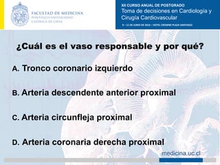 XII CURSO ANUAL DE POSTGRADO
Toma de decisiones en Cardiología y
Cirugía Cardiovascular
9	–	11	DE	JUNIO	DE	2016	–	HOTEL	CROWNE	PLAZA	SANTIAGO	
		 medicina.uc.cl
¿Cuál es el vaso responsable y por qué?
A.  Tronco coronario izquierdo
B.  Arteria descendente anterior proximal
C.  Arteria circunfleja proximal
D.  Arteria coronaria derecha proximal	
 