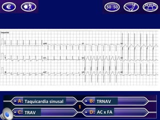 Taquicardia	sinusal	
TRAV	
TRNAV	
AC	x	FA	
 