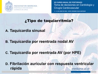 XII CURSO ANUAL DE POSTGRADO
Toma de decisiones en Cardiología y
Cirugía Cardiovascular
9	–	11	DE	JUNIO	DE	2016	–	HOTEL	CROWNE	PLAZA	SANTIAGO	
		 medicina.uc.cl
¿Tipo de taquiarritmia?
A.  Taquicardia sinusal
B.  Taquicardia por reentrada nodal AV
C.  Taquicardia por reentrada AV (por HPE)
D.  Fibrilación auricular con respuesta ventricular
rápida	
 