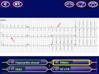 Taquicardia	sinusal	
TRAV	
TRNAV	
AC	x	FA	
 