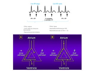 XII CURSO ANUAL DE POSTGRADO
Toma de decisiones e Cardiología y
Cirugía Cardiovascular
 