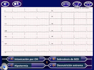 Intoxicación	por	OH	
Hipotermia	
Sobredosis	de	BZD	
Desnutrición	extrema	
 