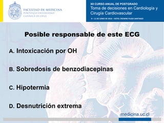 XII CURSO ANUAL DE POSTGRADO
Toma de decisiones en Cardiología y
Cirugía Cardiovascular
9	–	11	DE	JUNIO	DE	2016	–	HOTEL	CROWNE	PLAZA	SANTIAGO	
		 medicina.uc.cl
Posible responsable de este ECG
A.  Intoxicación por OH
B.  Sobredosis de benzodiacepinas
C.  Hipotermia
D.  Desnutrición extrema	
 