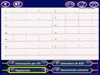 Intoxicación	por	OH	
Hipotermia	
Sobredosis	de	BZD	
Desnutrición	extrema	
 