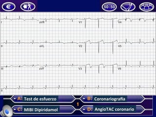 Test	de	esfuerzo	
MIBI	Dipiridamol	
CoronariograGa	
AngioTAC	coronario	
 