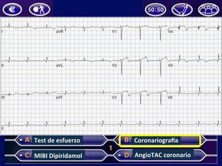 Test	de	esfuerzo	
MIBI	Dipiridamol	
CoronariograGa	
AngioTAC	coronario	
 