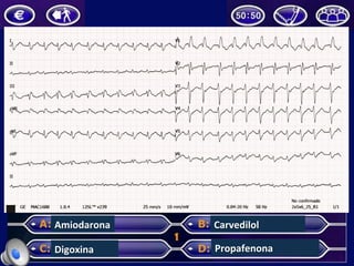 Amiodarona	
Digoxina	
Carvedilol	
Propafenona	
 