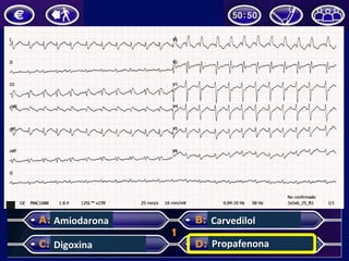 Amiodarona	
Digoxina	
Carvedilol	
Propafenona	
 