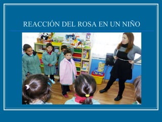 REACCIÓN DEL ROSA EN UN NIÑO
 
