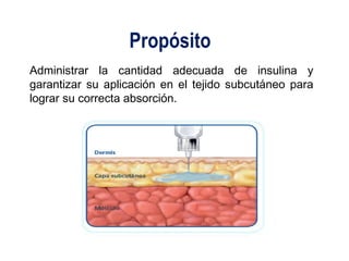 Propósito 
Administrar la cantidad adecuada de insulina y 
garantizar su aplicación en el tejido subcutáneo para 
lograr su correcta absorción. 
 