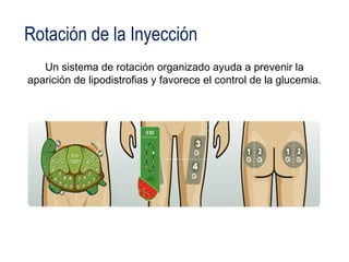 Rotación de la Inyección 
Un sistema de rotación organizado ayuda a prevenir la 
aparición de lipodistrofias y favorece el control de la glucemia. 
 