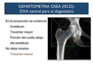 DENSITOMETRIA OSEA (ISCD):
DXA central para el diagnóstico
En la proyección se evidencia
Acetábulo.
Trocánter mayor
Porción del cuello abajo
del acetábulo
No debe mostrar
Trocánter menor
 
